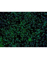 Human Adipose-derived Mesenchymal Stem Cells (HMSC-ad) - Immunostaining for CD73, 100x.