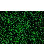 Human Adipose Microvascular Endothelial Cells (HAMEC) - Immunostaining for Factor VIII, 100x.