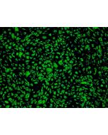 Human Adipose Microvascular Endothelial Cells (HAMEC) - Immunostaining for Factor VIII