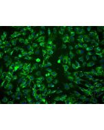 Human Amniotic Mesenchymal Stromal Cells (HAMSC) - Immunostaining for CD105, 200x.