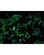 Human Aortic Adventitia Fibroblasts (HAAF) - Immunostaining for Fibronectin, 200x.