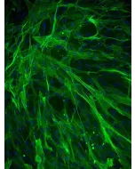 Human Aortic Smooth Muscle Cells (HASMC) - Immunostaining for α-SMA, 200x.