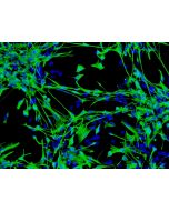 Human Astrocytes-brain stem (HA-bs) - mmunostaining for GFAP, 100x.