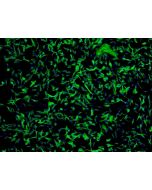 Human Astrocytes-cerebellar (HA-c) - Immunostaining for GFAP, 100x.