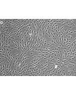 Human Bone Marrow-derived Mesenchymal Stem Cells (HMSC-bm) - Phase contrast