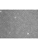 Human Bone Marrow-derived Mesenchymal Stem Cells (HMSC-bm) – Phase contrast, 100x.
