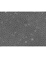 Human Brain Microvascular Endothelial cells (HBMEC) - Phase contrast, 100x.