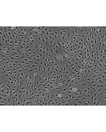 Human Brain Microvascular Endothelial cells (HBMEC) - Phase contrast, 100x.
