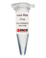 Human Calvarial Osteoblast Total RNA