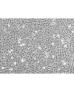 Human Chondrocytes-articular (HC-a) - Phase contrast, 100x.