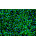 Human Dermal Fibroblasts-neonate (HDF-n) - Immunostaining for Fibronectin, 200x.