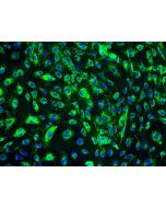 Human Dermal Lymphatic Endothelial Cells (HDLEC) - Immunostaining for Factor VIII, 200x.