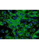Human Dermal Microvascular Endothelial Cells (HDMEC) - Immunostaining for Factor VIII, 400x.
