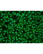 Human Dural Fibroblasts - Immunostaining for FN, 200X
