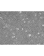 Human Dural Microvascular Endothelial Cells - Phase Contrast, 100X
