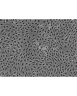 Human Endometrial Microvascular Endothelial Cells (HEMEC)-Phase Contrast