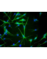 Human Epidermal Melanocytes-medium (HEM-m) - Immunostaining for S100-β, 400x.
