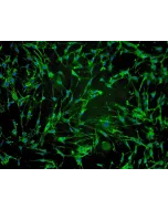 Human Hair Dermal Papilla Cells (HHDPC) - Immunostaining for Fibronectin, 100x.
