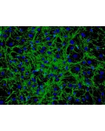 Human Hair Germinal Matrix Cells (HHGMC) - Immunostaining for Fibronectin, 200x.
