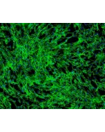 Human Hair Inner Root Sheath Cells (HHIRSC) - Immunostaining for Fibronectin, 100x.
