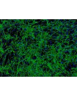 Human Hair Outer Root Sheath Cells (HHORSC) - Immunostaining for Fibronectin, 100x.
