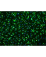 Human Hepatic Sinusoidal Endothelial Cells (HHSEC) - Immunostaining for vWF, 200x
