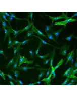 Human Hepatic Stellate Cells (HHSteC) - Immunostaining for α-SMA, 400x.
