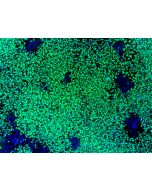 HiPSC-Derived Neural Crest Cells (HiPSC-NCC) - Immunostaining for SOX10, 100x