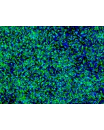 HiPSC-Derived Neural Stem Cells (HiPSC-NSC) - Immunostaining for Nestin, 200x
