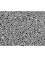 Human Keratocytes (HK) - Phase contrast, 100x.
