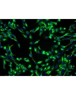 Human Lens Epithelial Cells (HLEpiC) - Immunostaining for CK-19, 200x.
