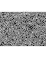 Human Liver-derived Mesenchymal Stem Cells (HMSC-he) - Phase contrast, 100x.