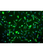 Human Mammary Epithelial Cells (HMEpiC) - Immunostaining for CK-18, 200x.
