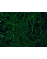 Human Mammary Fibroblasts (HMF) - Immunostaining for Fibronectin, 100x
