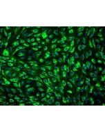 Human Mammary Microvascular Endothelial Cells (HMMEC) - Immunostaining for vWF, 200x.
