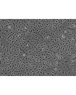 Human Myometrial Microvascular Endothelial Cells (HMMEC)-Phase Contrast, 200x.