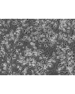 Human Neurons-hippocampal (HN-h) - Phase contrast, 200x.
