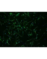 Human Neurons HN - immunostained for beta tubulin III (green), 200x
