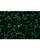 Human Oligodendrocyte Precursor Cells (HOPC) - Immunostaining for A2B5, 100x.
