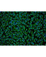 Human Perineurial Cells (HPNC) - Immunostaining for Vimentin