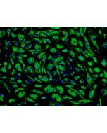 Human Pulmonary Microvascular Endothelial Cells (HPMEC) - Immunostaining for Factor VIII, 200x.