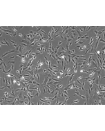 Human Retinal Astrocytes (HRA) - Phase contrast, 100x.
