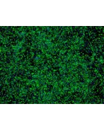 Human Retinal Pigment Epithelial Cells (HRPEpiC) - Immunostaining for CK-18, 200x.
