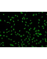 Human Sertoli Cells (HSerC)-Immunostaining for SOX-9, 200x.

