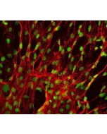 Human Splenic Fibroblasts (HSF) - Immunostaining for Fibronectin, 400x.
