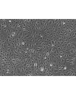 Human Testicular Endothelial Cells (HTEC)-Phase contrast, 100x.
