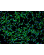 Human Thymic Fibroblasts (HTyF) - Immunostaining for Fibronectin, 200x.
