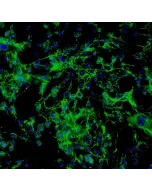 Human Thyroid Fibroblasts (HThF) - Immunostaining for Fibronectin, 200x.
