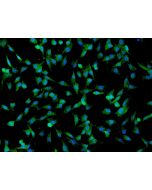 Human Umbilical Mesenchymal Stem Cells (HUMSC) - Immunostaining for CD73, 200x.