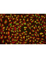 Human Umbilical Vein Endothelial Cells (HUVEC) - Immunofluorescence for Factor VIII (Sigma-Aldrich Cat.#F3520), 200x.